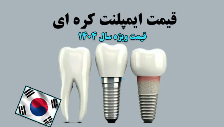 وبلاگ درنیکا 2 قیمت ایمپلنت کره ای در تهران
