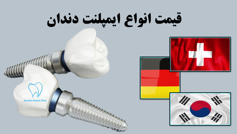 قیمت ایمپلنت دندان 1404 (هزینه ایمپلنت در تهران + ضمانت کتبی) 9 قیمت ایمپلنت دندان